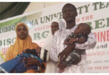 MAUTH Yola discharges successfully separated conjoined twins